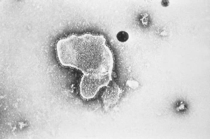 Respiratory_Syncytial_Virus_RSV_EM_PHIL_2175_lores.jpg